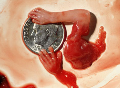 abortion24